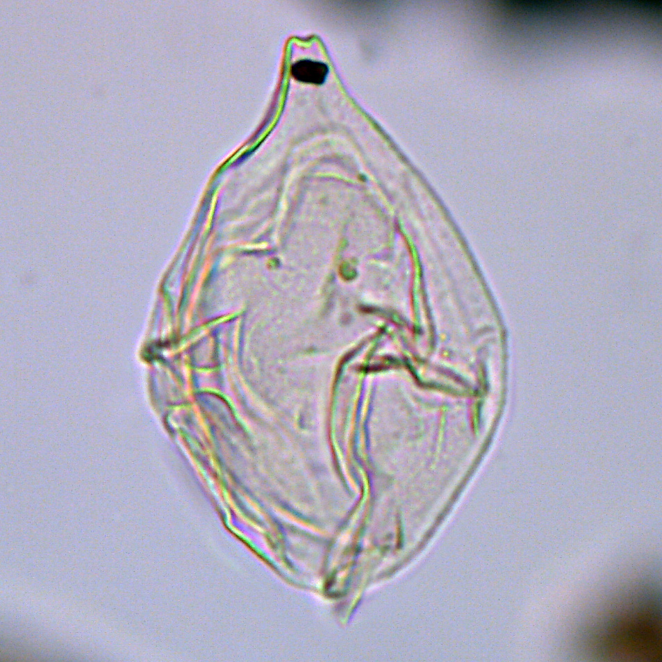 Isabelidinium acuminatum, U1581-23R-2W, 119-124, sl. 1, O29-1, foto-b.jpg